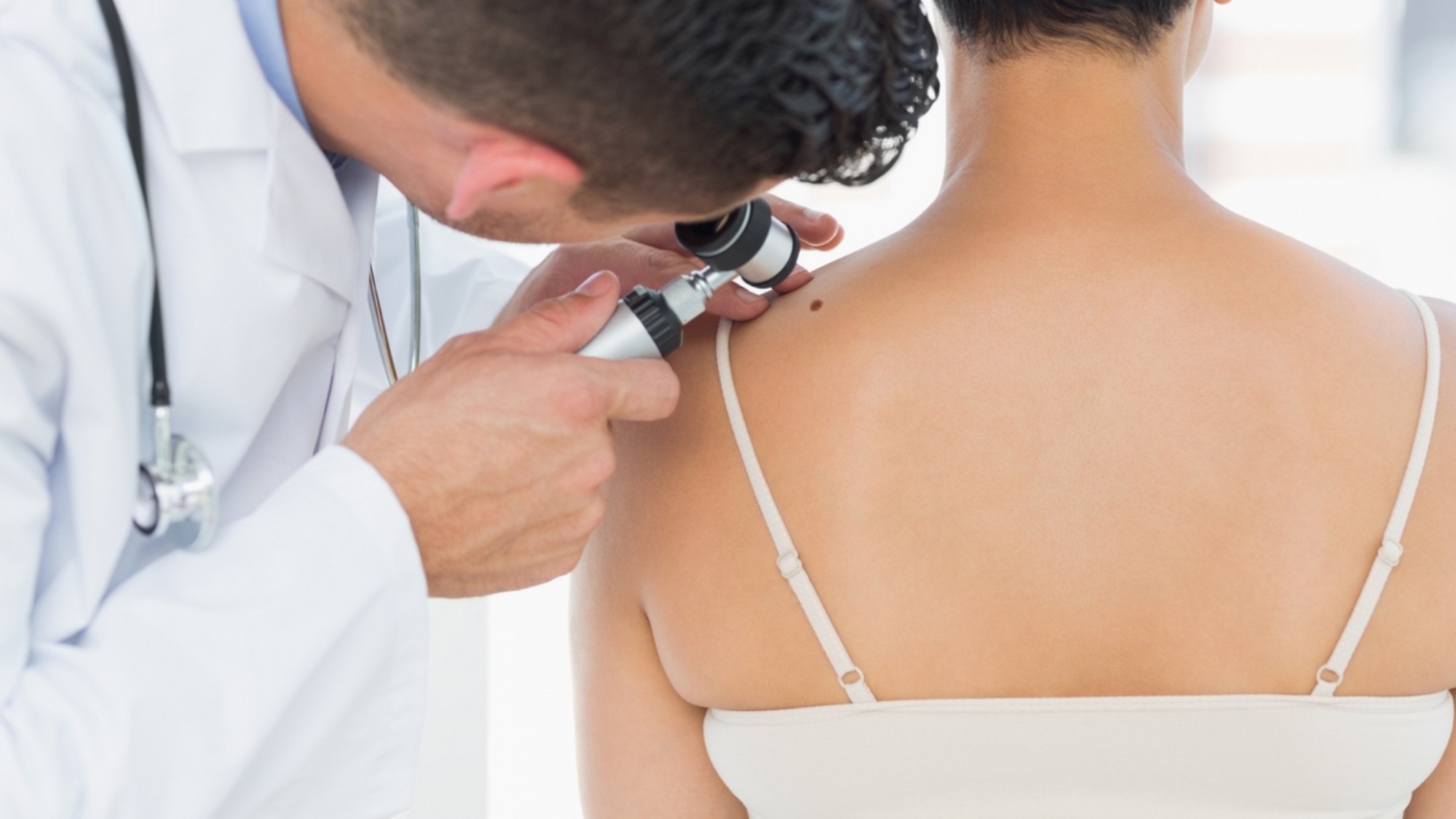 Dermatologist examining mole on back of woman